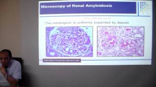 FMF and renal amyloidosis prof Ayman Refaie Mansoura UNC [upl. by Blount382]