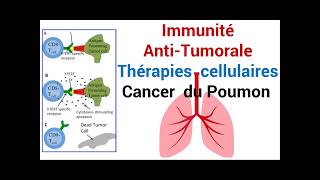 Cancer du Poumon Réponse de lImmunité AntiTumorale Thérapie cellulaire [upl. by Aikem]