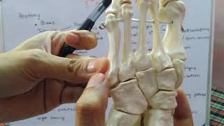 شرح كل كسور استقبال العظام فى ساعتين  2 Fracture Base Of Fifth Metatarsal Bone [upl. by Olram]