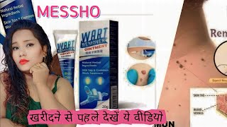 Wart Remover Review 2023 Instant Blemish Removal Gel [upl. by Onirefes]