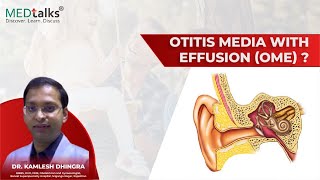 Otitis Media with Effusion OME [upl. by Eduj]