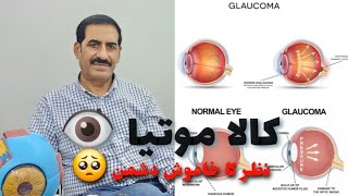 Eye  Glaucoma کالا موتیا  نظر کا خاموش دشمن [upl. by Aynnat]