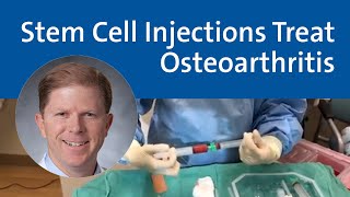 Stem Cell Injections Treat Osteoarthritis  Duke Health [upl. by Ahseirej]