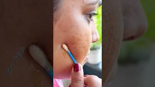 7Days Dark Spots amp Pigmentation Removal ChallengeGet Rid Of Dark SpotsGet Glowing Skin shorts [upl. by Lory76]