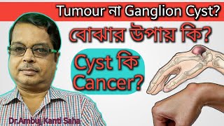 All in one solution for Ganglion cyst  Homeopathic medicine for Ganglion  Causes Sign amp Symptoms [upl. by Kevon]