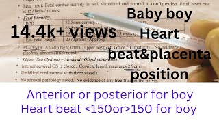 My baby reports placenta position and heart beat of gender based on placenta positionbaby reports [upl. by Assilev]