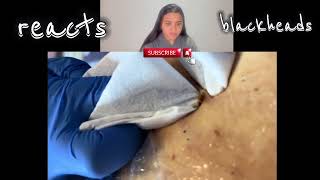 blackheads nose blackheads removal satisfying blackheads removal lips blackheads removal ear [upl. by Einahpats710]