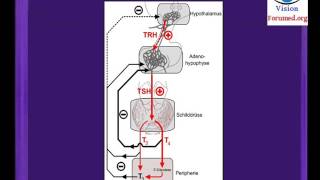 Hypothyroidie comment reconnaitre goitre debutant Glande thyroïdienne nodulaire symptomes nodule [upl. by Ainesey656]