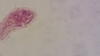 Miracidium of Fasciola hepatica [upl. by Peace]