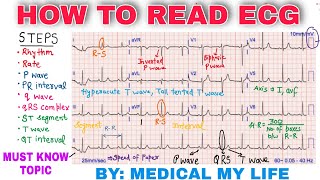 How To Read An ECG [upl. by Akeenat]