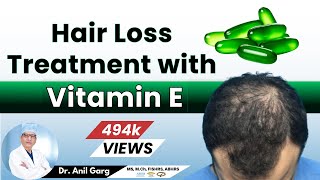 Hair loss Treatment with Vitamin E  बालो के लिए घरेलु उपचार  Vitamin E Capsule For Hair Growth [upl. by Switzer425]