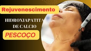 COMO REJUVENESCER O PESCOÇO BIOESTIMULADOR HIDROXIAPATITA DE CALCIObiometil rejuvenescimento [upl. by Scheld185]