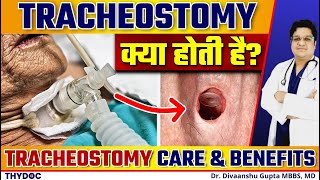 Tracheostomy क्या होती है  जानिए Tracheostomy के Benefits और Tracheostomy Care कैसे करें in Hindi [upl. by Sutphin250]