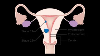 Ciclo menstrual ovárico y endometrial [upl. by Atinas719]