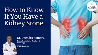 How to Know If You Have a Kidney Stone  Dr Upendra Kumar N  CARE Hospitals Nampally [upl. by Aniret]