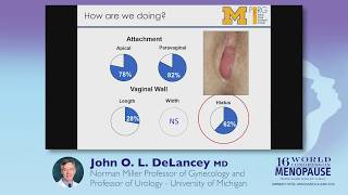 Optimizing the Pelvic Floor  a Symposium by John DeLancey [upl. by Moia]