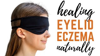 Healing Eyelid Eczema Naturally  Eyelid Atopic Dermatitis Triggers [upl. by Musetta9]