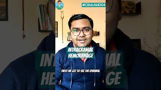 Intracranial Hemorrhage under 60 seconds quick review for USMLE NEET PG INICET NCLEX [upl. by Haya]