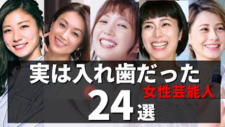 実は入れ歯・インプラント・義歯な女性芸能人・有名人24選 [upl. by Sylvan]