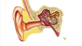 Menieres Disease  WVU Medicine Health Report [upl. by Sitoeht]