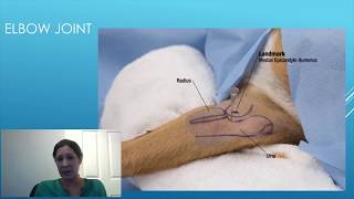 Intra articular Knee Joint Cortisone Injection [upl. by Aelhsa622]