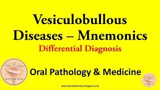 MNEMONICS  Vesiculobullous Diseases Differential Diagnosis  Oral Medicine and Pathology [upl. by Erdreid]