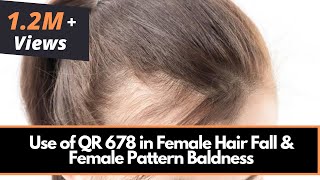 Use of QR 678 in Female Hair Fall amp Female Pattern Baldness  Dr Rinky Kapoor [upl. by Cadal752]