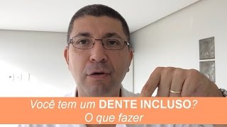 Você tem um DENTE INCLUSO O que fazer  Dica do Dia 005365 [upl. by Power]