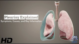 Pleurisy Unveiled Understanding Symptoms Causes and Vital Information [upl. by Miarhpe112]