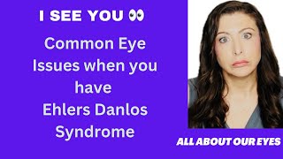 Common Eye Problems with Ehlers Danlos Syndrome [upl. by Nahoj976]