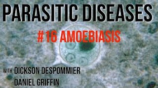 Parasitic Diseases Lectures 16 Amoebiasis [upl. by Perkoff]