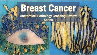 Breast Cancer  Anatomical Pathology Grossing Review Series [upl. by Morten]