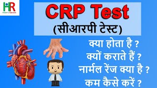 CRP test  CReactive Protein CRP test  CRP test in hindi  High सीआरपी level का क्या मतलब है [upl. by Htenek998]