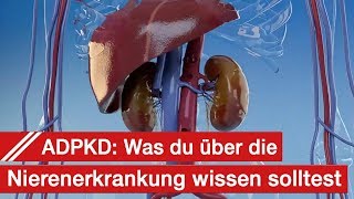 ADPKD  Wissen über Zystennieren Symptome Diagnose Therapie und Alltag [upl. by Wenn798]