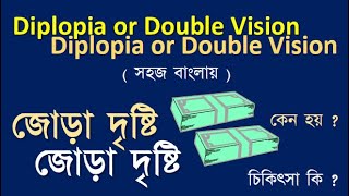 Diplopia or Double vision causes and treatment diplopia doublevision diplopiacausesandtreatment [upl. by Lemmueu]