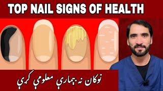 6 NAIL SIGNS of HEALTH PROBLEMS  Dr Adnan Khan [upl. by Davidde]