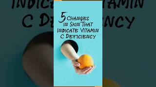 Vitamin C Deficiency Symptoms  EduCare  Natural Cure amp Tips vitamincdeficiency symptoms [upl. by Flossie588]