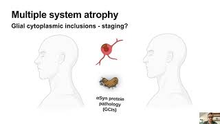 AlphaSynuclein Strains in Synucleinopathies [upl. by Davine]