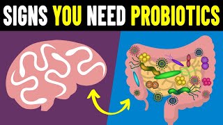 9 Signs You Need To Take Probiotics [upl. by Eelrac36]