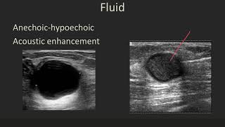 Ultrasound 101 Part 5 Terminology and Tissuesmp4 [upl. by Francklyn470]