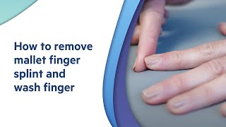 How to remove mallet finger splint and wash finger  explained by an Orthopaedic Surgeon [upl. by Htebsle213]