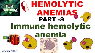 Hemolytic Anemias Part 8 Immune Hemolytic Anemia IHA [upl. by Maegan]