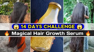 Magical Rice Hair Growth Serum at Home 😱  Rice Hair Growth Serum  how to grow hair naturally [upl. by Seaman]