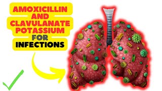 Amoxicillin and Clavulanate Potassium A DualAction Antibiotic for Bacterial Infections [upl. by Honoria]