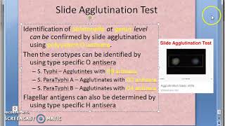 Microbiology 321 f Salmonella Typhoid Lab Diagnosis Slide Agglutination [upl. by Anot944]