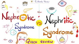 Nephrotic AND Nephritic Syndrome  Quick Review  Nephrology amp Pathology [upl. by Agler]