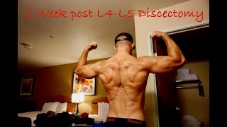 1 Week Post L4L5 Discectomy [upl. by Rabbi]