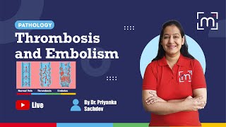 Thrombosis and Embolism with Dr Priyanka Sachdev [upl. by Ynafetse]