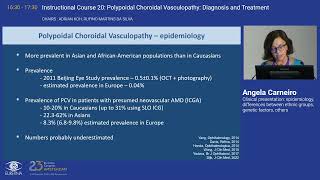 2 Clinical presentation epidemiology differences between ethnic groups genetic factors others [upl. by Aticilef]