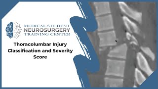 Thoracolumbar Injury Classification and Severity Score [upl. by Gregoire]